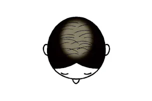 女ですが顎に太いヒゲ4本 抜くべきですか Nikkei Style 女ですが顎に太いヒゲ4本 抜くべきですか Nikkei Style