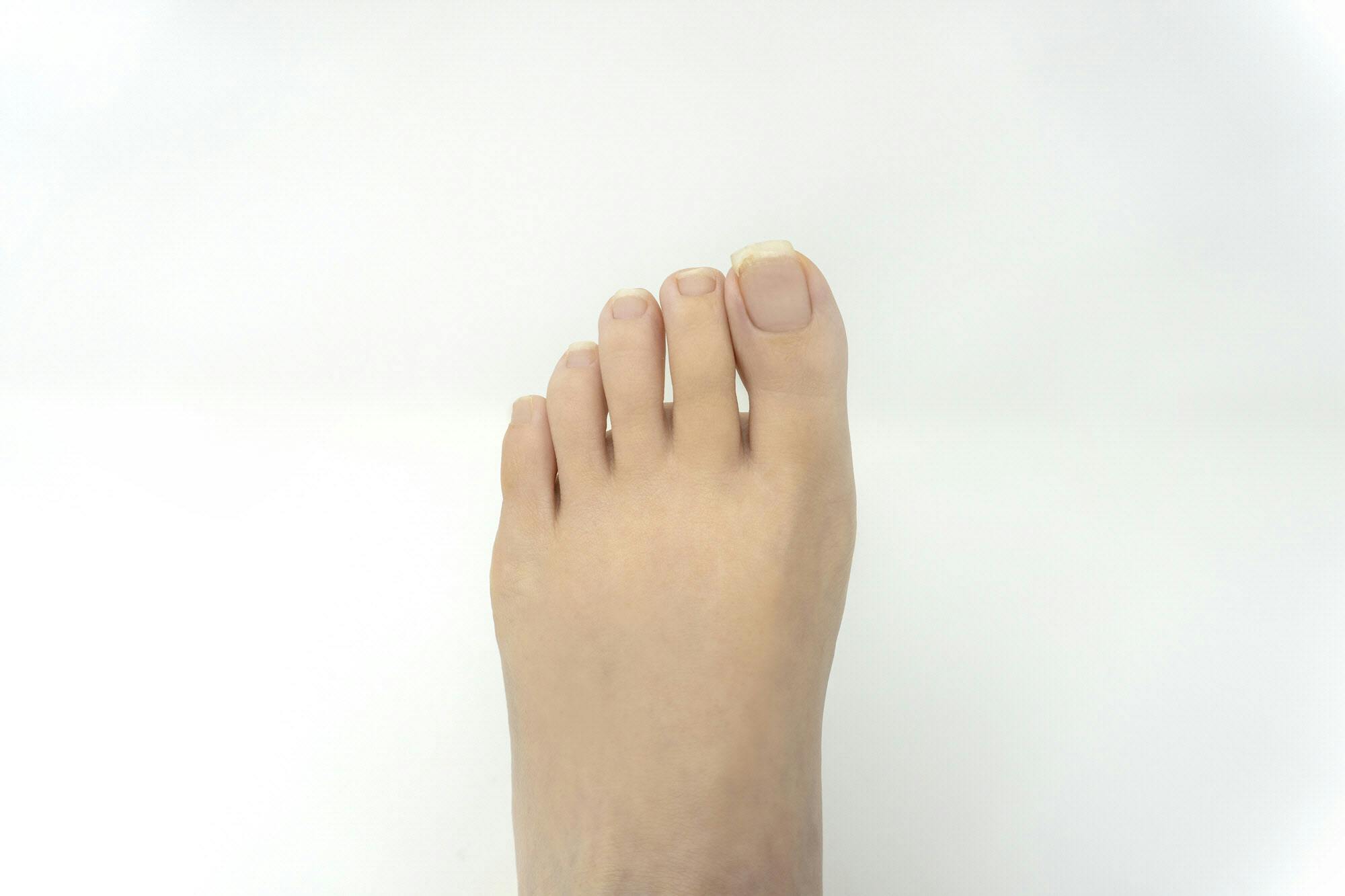 足の爪トラブル早めのケアで予防 体支える親指に多く Nikkei Style 足の爪トラブル早めのケアで予防 体支える親指に多く Nikkei Style