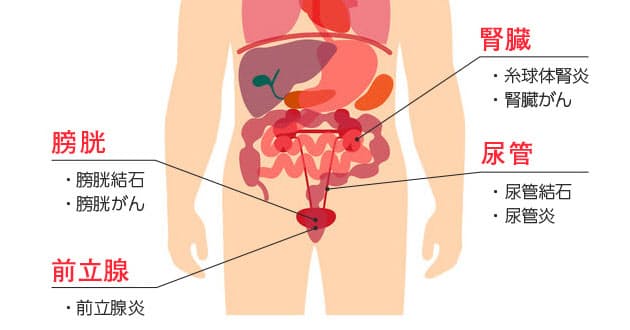 答えと解説 尿の色は病気のサイン 茶色 白 透明で注意するのは Nikkei Style 答えと解説 尿の色は病気のサイン 茶色 白 透明で注意するのは Nikkei Style