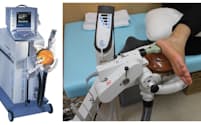 写真1　ドルニエ エイポスウルトラ（左）を用いた足底腱膜炎治療。足首を載せているオレンジ色のウォータークッション下から衝撃波が発生する（機器写真はドルニエメドテックジャパン提供、治療写真は洛和会丸太町病院で撮影）