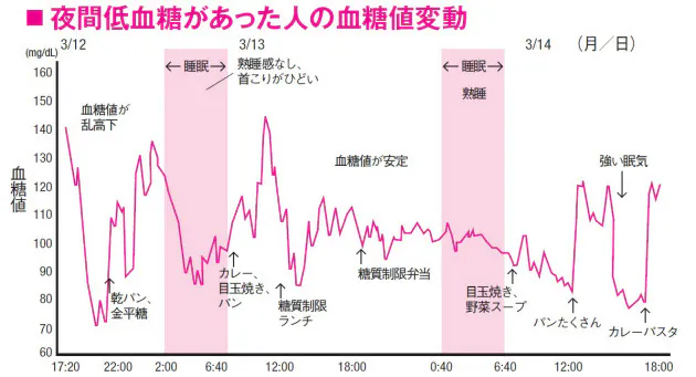 歯ぎしり 寝汗 潜む意外な原因 夜間低血糖 Nikkei Style