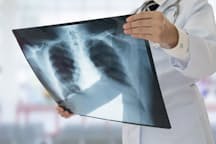 答えと解説 運動で大きくなった スポーツ心臓 元に戻るの Nikkei Style 答えと解説 運動で大きくなった スポーツ心臓 元に戻るの Nikkei Style