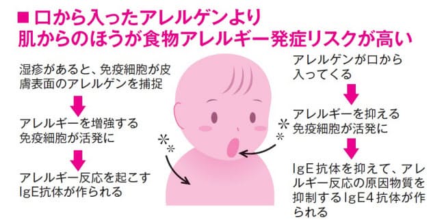 食物アレルギーは肌の湿疹から始まる 乳児期から保湿を Nikkei Style 食物アレルギーは肌の湿疹から始まる 乳児期から保湿を Nikkei Style