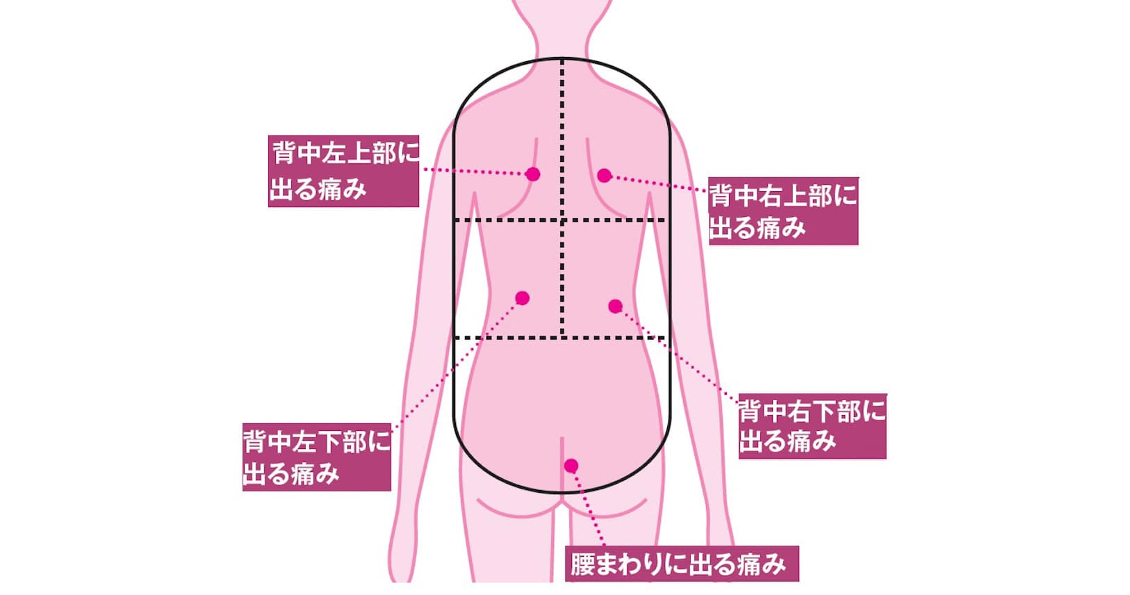 背中 痛み 右 背中が痛む！痛む場所ごとに図で見る14の原因：肩こり？それとも他の病気？