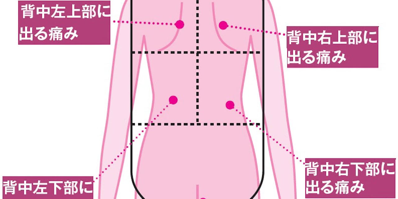 痛い 重い だるい 腰の痛み 内臓疾患の可能性 Nikkei Style 痛い 重い だるい 腰の痛み 内臓疾患の可能性 Nikkei Style