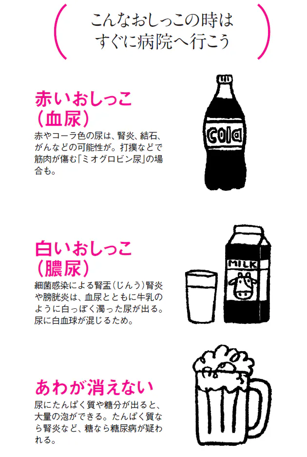 おしっこの色が濃くなったら それは脱水のサイン Nikkei Style
