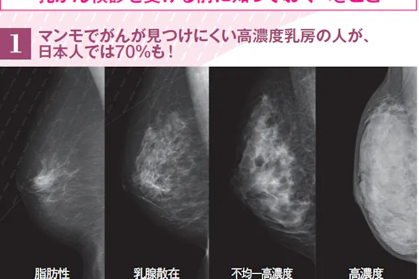 乳がん早期発見 超音波活用探る 40代も見つけやすく Nikkei Style