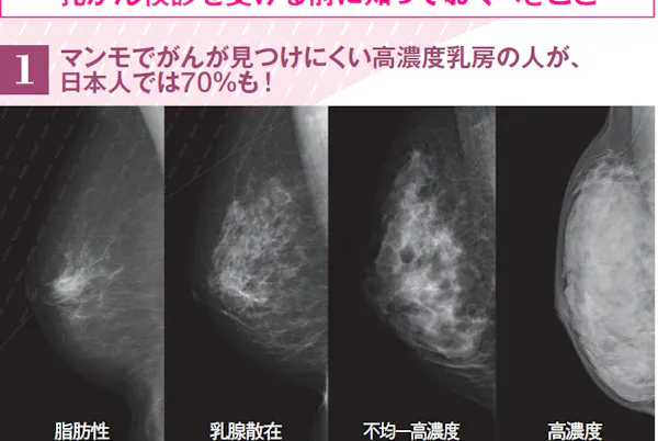 北斗晶さんの告白から学ぶ 乳がん検診の受診ポイント Nikkei Style