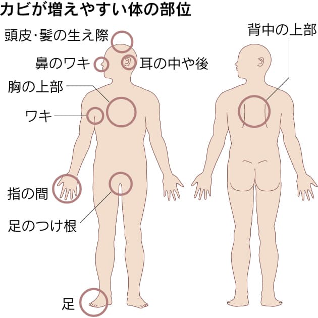 胸の谷間 痒い 湿疹