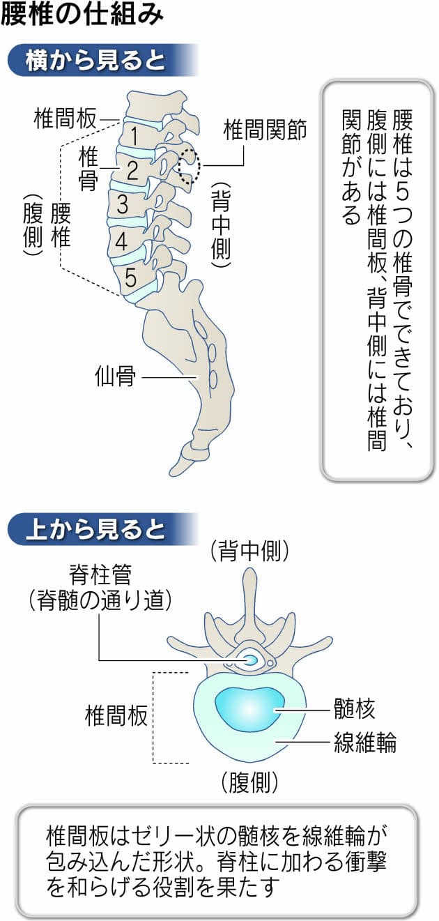 誰にも起こる ぎっくり腰 音なし増加中 Nikkei Style