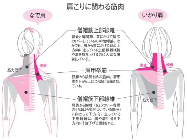 いかり肩 なで肩 タイプによって違う肩こり対処法 ゆがみリセット学 3 Nikkei Style