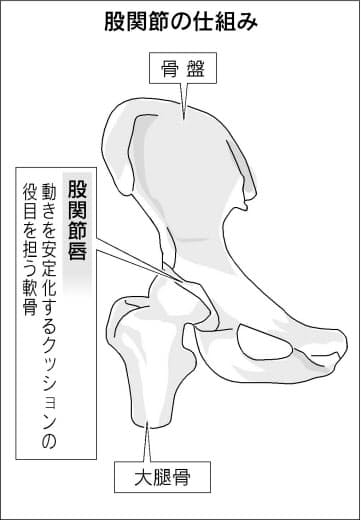 股関節 痛い