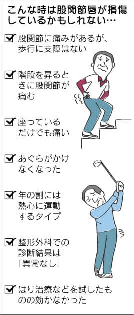 股関節の痛みに新タイプ 働き盛り 運動しすぎ注意 Nikkei Style