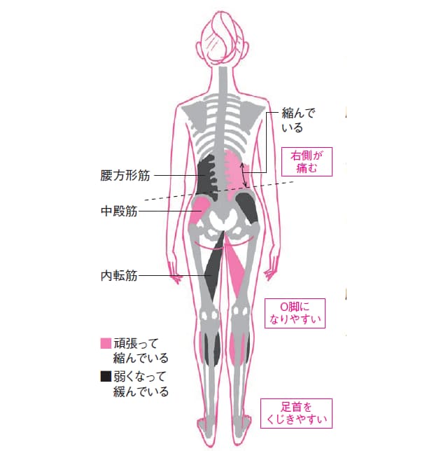 左右バランスを整えて腰痛解消 ゆがみリセット学 5 Nikkei Style