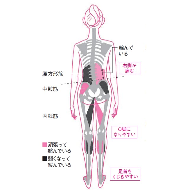 右 の 骨盤 が 痛い