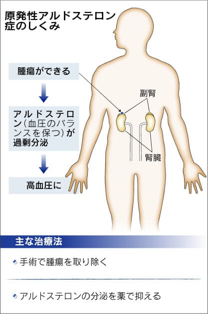 遺伝 高血圧