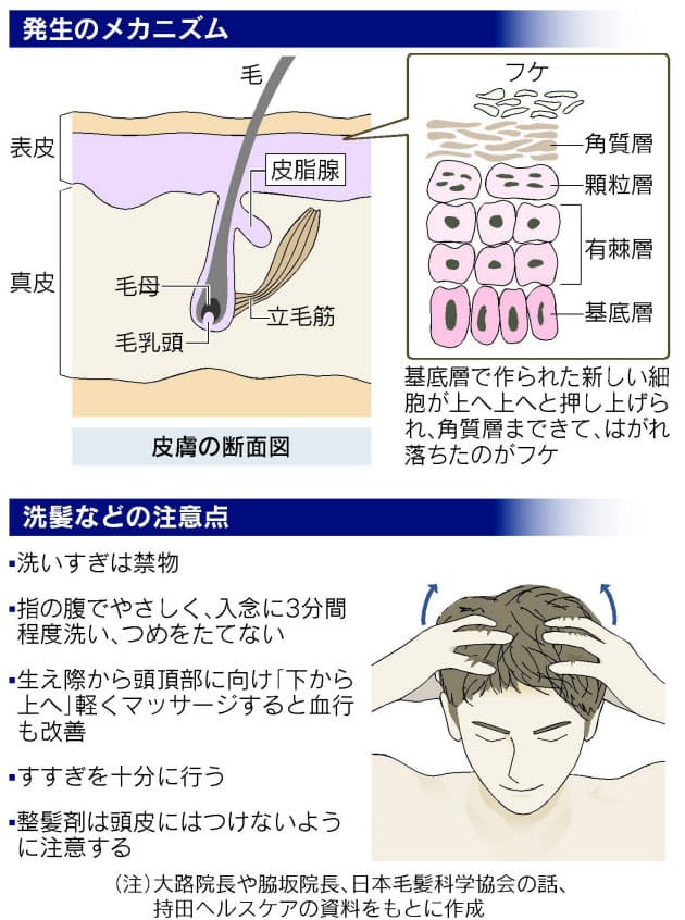 洗髪は男性1日1回 女性2日1回 フケを防ぐ頭皮ケア 日経bizgate