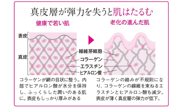 たるみに効く コラーゲンのとり方 日経bizgate