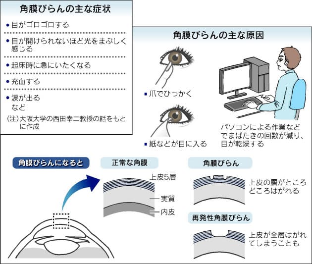 する ゴロゴロ 目 片目 だけ が 目がゴロゴロする――「目の違和感」から考えられる病気