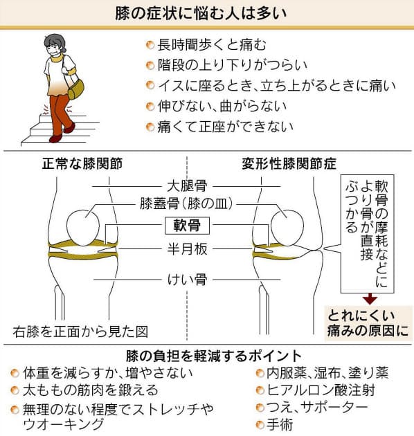 皿 周りをストレッチ 膝の痛みを軽減する方法 ヘルスｕｐ Nikkei Style