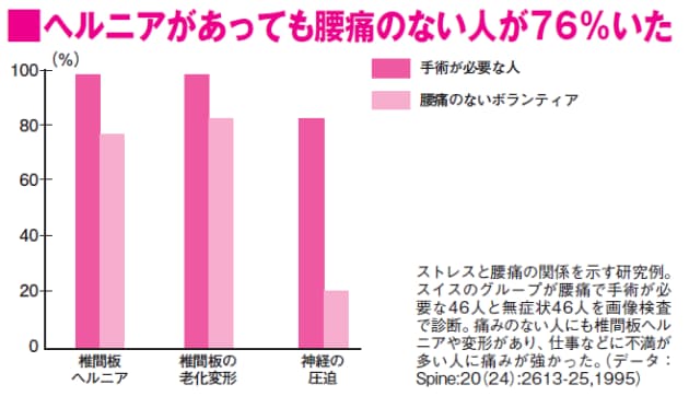 慢性腰痛には安静より運動 腰痛治療の新常識 日経bizgate 慢性腰痛には安静より運動 腰痛治療の新常識 日経bizgate