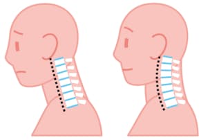 腕の痛み だるさ パソコン疲れには 腕もみ で Nikkei Style 腕の痛み だるさ パソコン疲れには 腕もみ で Nikkei Style