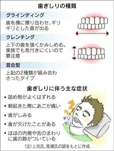 原因 歯ぎしり