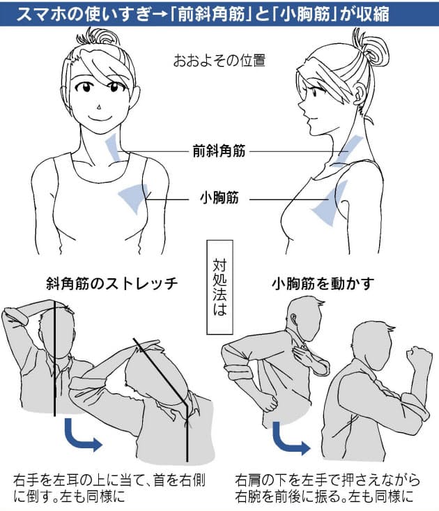 スマホの使いすぎで 首こり 女性は特に注意 Nikkei Style