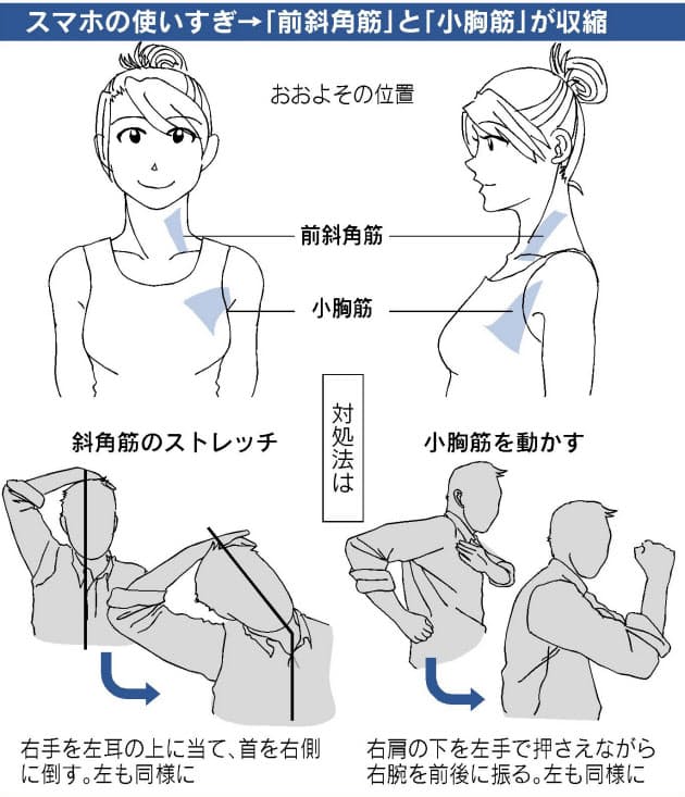 スマホの使いすぎで 首こり 女性は特に注意 日経bizgate スマホの使いすぎで 首こり 女性は特に注意 日経bizgate
