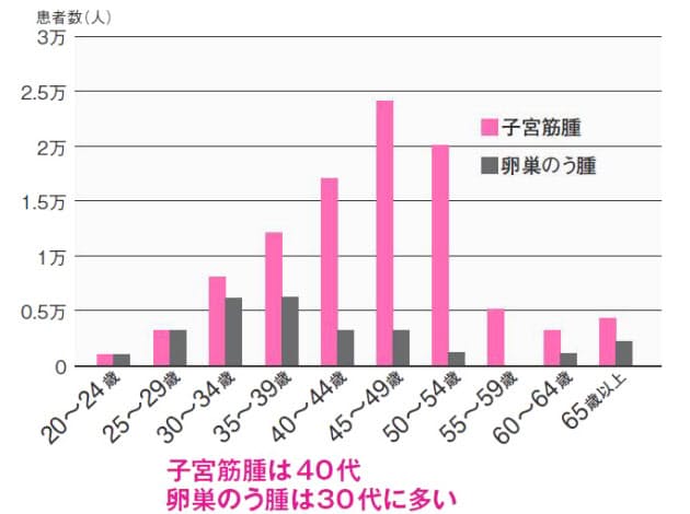 卵巣 の う 腫 症状 チェック