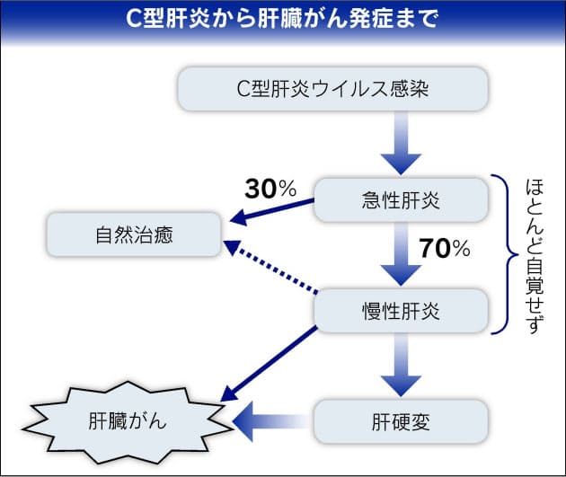 C型肝炎治療 新薬で期間半減 ウイルスを撃退 Nikkei Style C型肝炎治療 新薬で期間半減 ウイルスを撃退 Nikkei Style