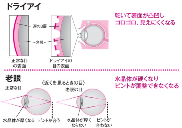 疲れ目を防ぐ5カ条 ドライアイ 老眼に打つ手あり Nikkei Style 疲れ目を防ぐ5カ条 ドライアイ 老眼に打つ手あり Nikkei Style