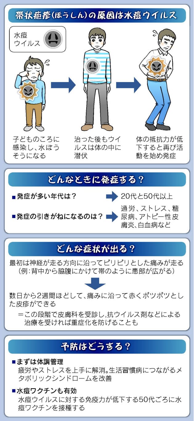 疱疹 治る まで 帯状 帯状疱疹は薬で治る？治療期間、新薬、ジェネリックも登場