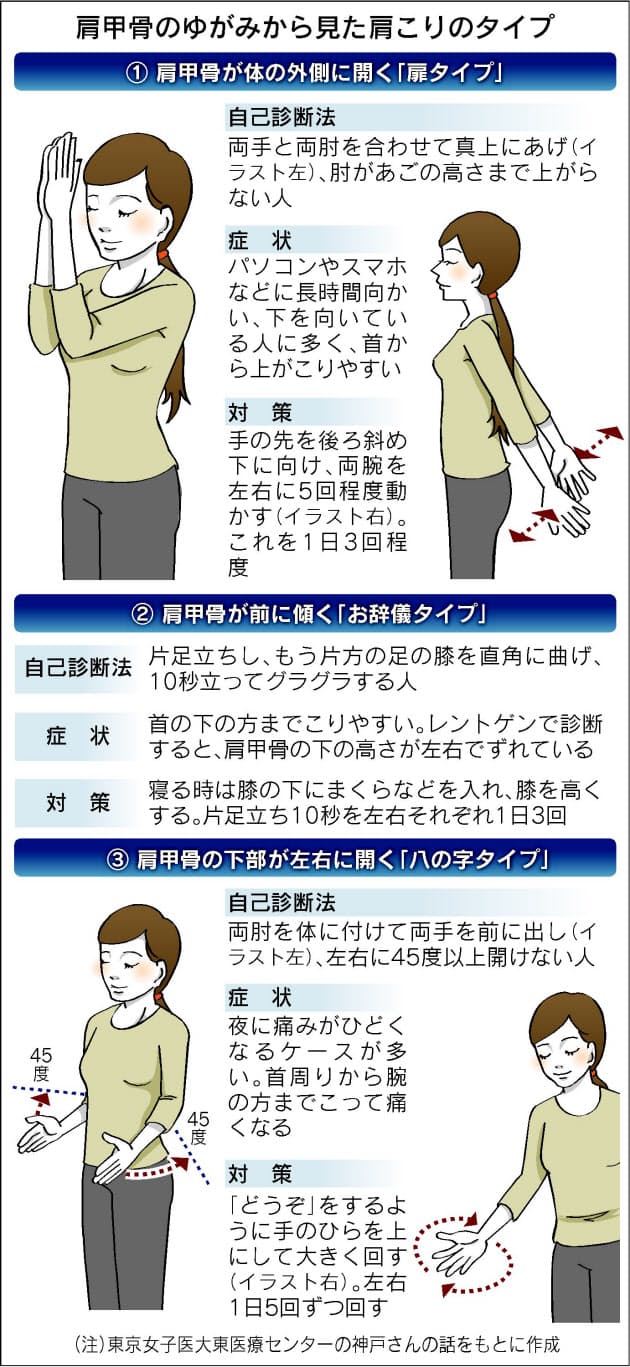 肩こりは もと から改善 肩甲骨のずれを正す Nikkei Style
