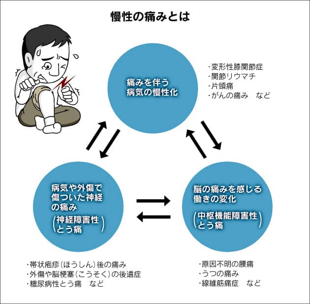 なぜか続く痛み 慢性痛 治療に新たなアプローチ Nikkei Style なぜか続く痛み 慢性痛 治療に新たなアプローチ Nikkei Style