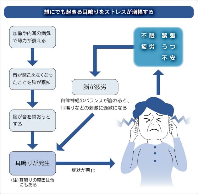 解明進む耳鳴りの正体 内耳に異常 ストレス影響 Nikkei Style 解明進む耳鳴りの正体 内耳に異常 ストレス影響 Nikkei Style