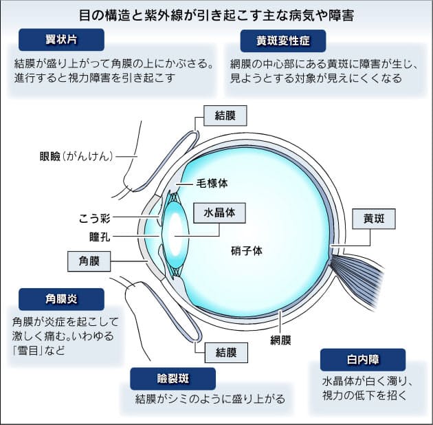 目の日焼け にご用心 白内障の原因にも Nikkei Style