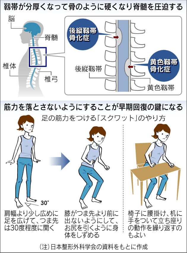 星野監督がかかった 靱帯骨化症 若手も発症 Nikkei Style