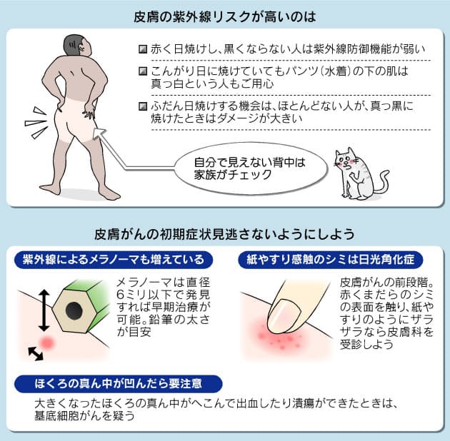 シミががん化も 見逃すな 皮膚からの警告 Nikkei Style