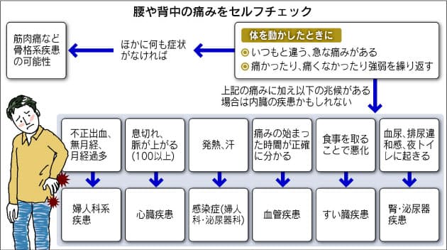 腰や背中の痛み 放置しないで ヘルスｕｐ Nikkei Style