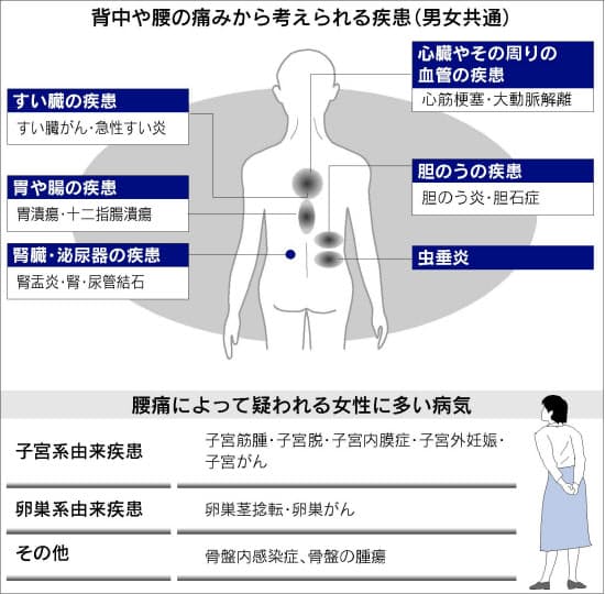 腰 痛み 左 内臓 の