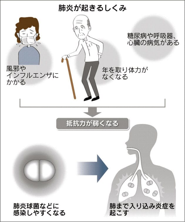 高齢者に多い肺炎 定期予防接種 原則65歳以上に助成 Nikkei Style 高齢者に多い肺炎 定期予防接種 原則65歳以上に助成 Nikkei Style