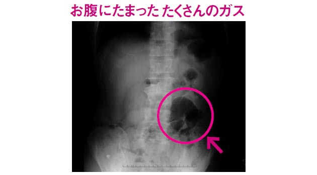 仰向けになるとお腹が鳴る