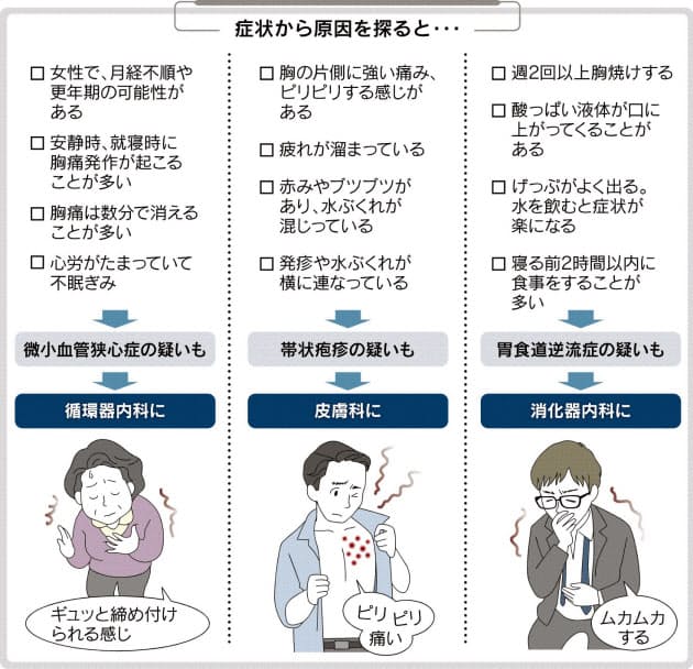 食道炎 長引く胸の違和感 痛み Nikkei Style
