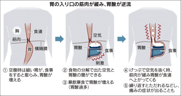 よく に 違和感 が 出る ゲップ 喉 【喉に空気がたまる感じ】この原因は？空気呑気症に注意！効果的な対処法を紹介