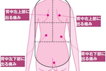 痛い 重い だるい 腰の痛み 内臓疾患の可能性 ヘルスｕｐ Nikkei Style