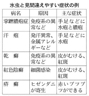 足 の 皮 が むける 水虫 以外