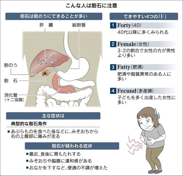 胆石症になりやすい4つの F 対策は ヘルスｕｐ Nikkei Style