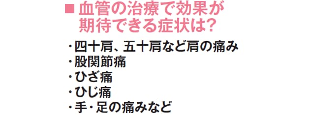 原因不明のしつこい痛み 犯人は もやもや血管 かも Nikkei Style 原因不明のしつこい痛み 犯人は もやもや血管 かも Nikkei Style