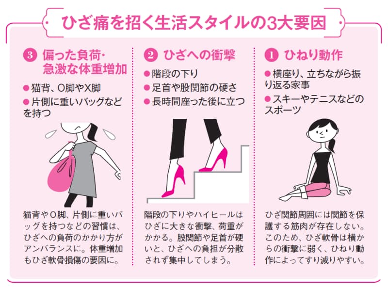 ひざ痛に筋トレ は誤り 始まりは靱帯の過緊張 Nikkei Style